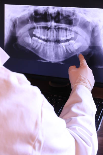 Best Dental Abscess Treatment in Southfield, MI