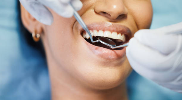 Best Broken or Chipped Tooth Repair in Southfield, MI